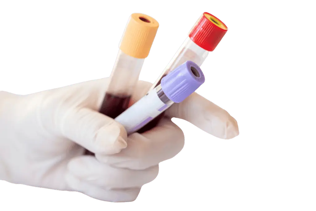 Blood Work At home dubai