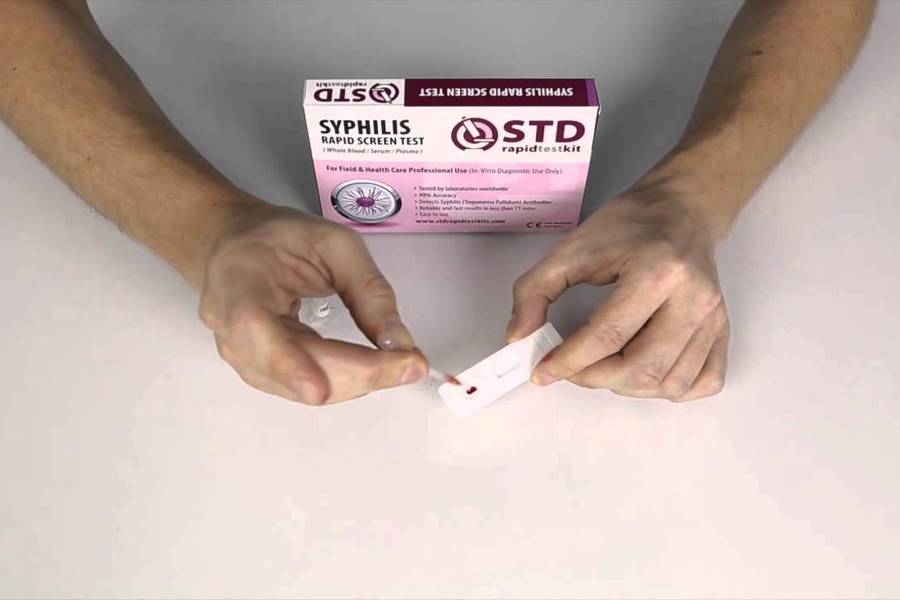 HIV TEST DUBAI