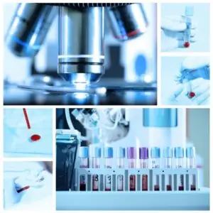 LAb test Dubai at home service