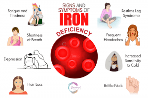 Iron deficiency anaemia. Iron IV drip Dubai