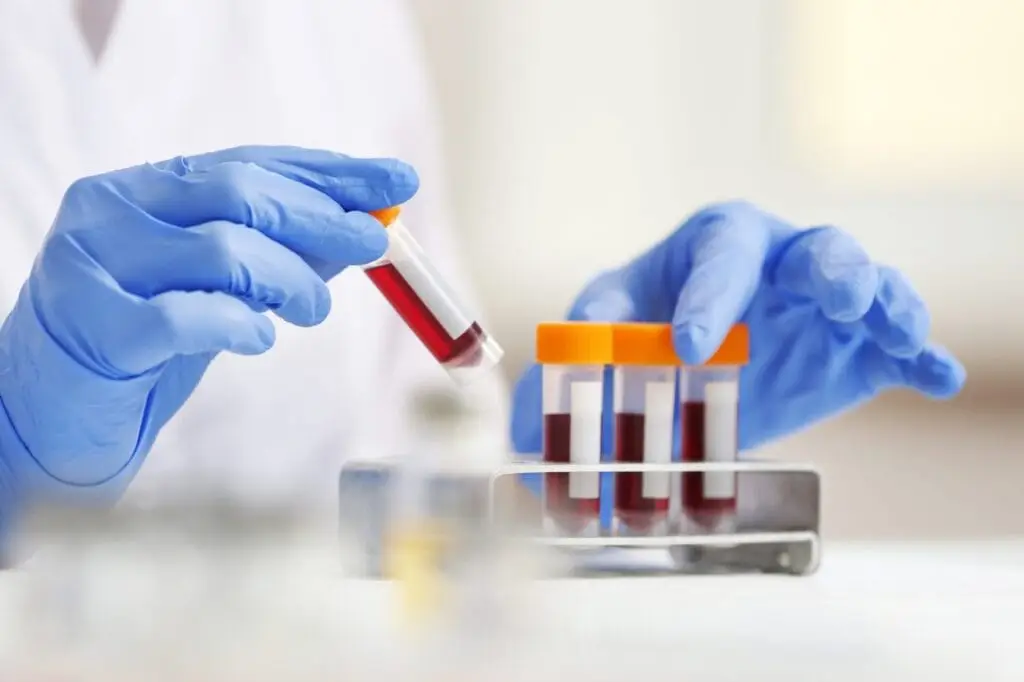 Blood test at home In Dubai