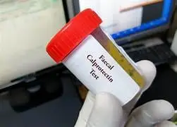 fecal calprotectin test